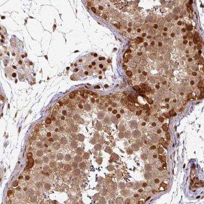 Immunohistochemistry-Paraffin: SIK3 Antibody [NBP2-47278]