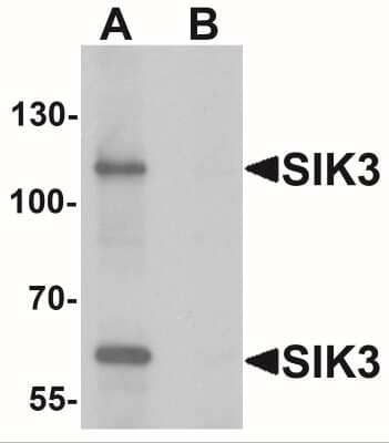 Western Blot: SIK3 AntibodyBSA Free [NBP2-41147]