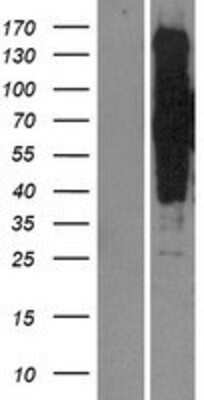 Western Blot: SIK3 Overexpression Lysate [NBP2-06235]