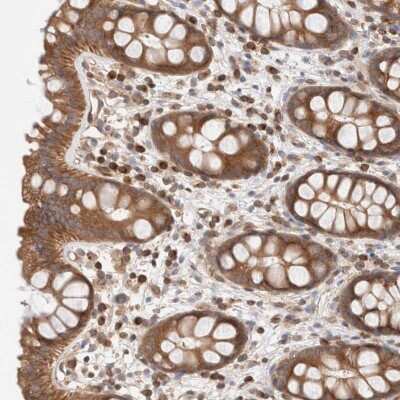 Immunohistochemistry-Paraffin: SIKE1 Antibody [NBP1-82151]