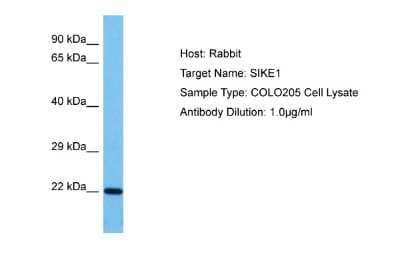 Western Blot: SIKE1 Antibody [NBP2-85732]