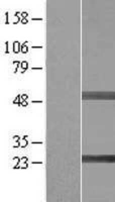 Western Blot: SIKE1 Overexpression Lysate [NBL1-15965]