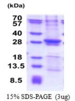 SDS-PAGE: Recombinant Human SIKE1 His Protein [NBP2-51631]