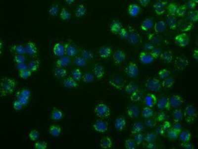 Immunocytochemistry/ Immunofluorescence: SIL1 Antibody (OTI3E3) [NBP2-02377]