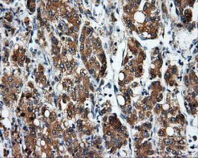 Immunohistochemistry-Paraffin: SIL1 Antibody (OTI3E3) [NBP2-02377]