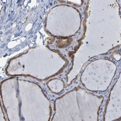 Immunohistochemistry-Paraffin: SIL1 Antibody [NBP1-88713]