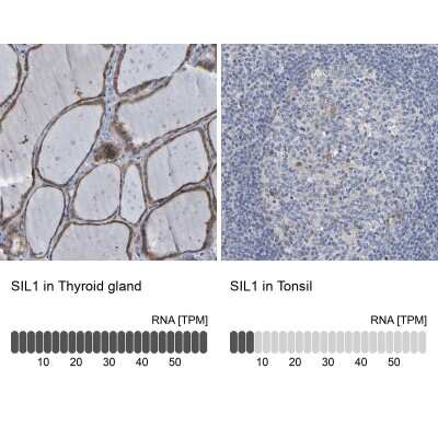 Immunohistochemistry-Paraffin: SIL1 Antibody [NBP1-88713]