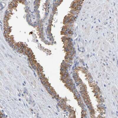 Immunohistochemistry-Paraffin: SIL1 Antibody [NBP1-88713]