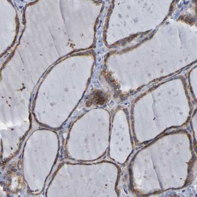 Immunohistochemistry-Paraffin: SIL1 Antibody [NBP1-88713]