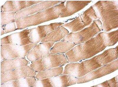 Immunohistochemistry-Paraffin: SIL1 Antibody [NBP2-20365]