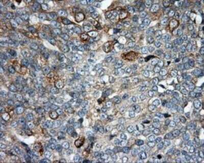 Immunohistochemistry: SIL1 Antibody (OTI3E3) - Azide and BSA Free [NBP2-74193]