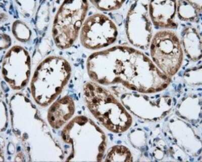 Immunohistochemistry: SIL1 Antibody (OTI3E3) - Azide and BSA Free [NBP2-74193]