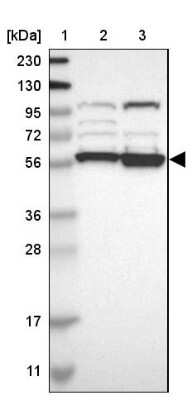 Western Blot: SIL1 Antibody [NBP1-88713]