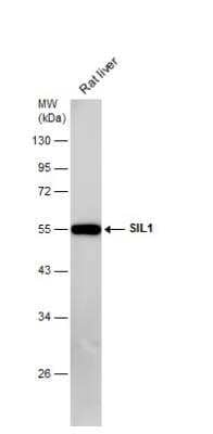 Western Blot: SIL1 Antibody [NBP2-20364]