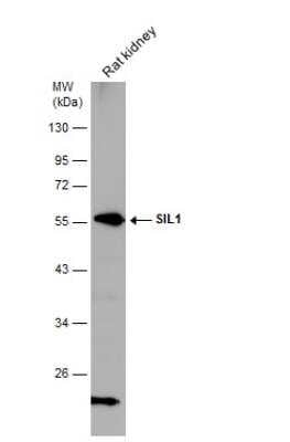 Western Blot: SIL1 Antibody [NBP2-20365]