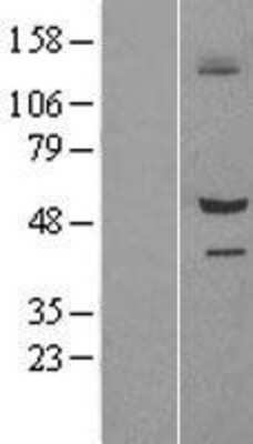 Western Blot: SIL1 Overexpression Lysate [NBL1-15966]