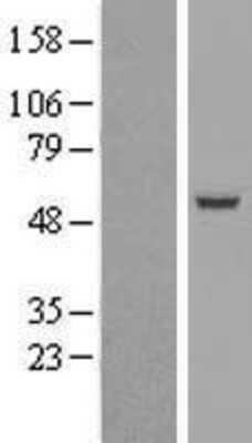 Western Blot: SIL1 Overexpression Lysate [NBL1-15967]