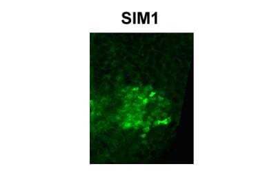 Immunohistochemistry: SIM1 Antibody [NBP2-84260]