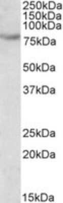 Western Blot: SIM2 Antibody [NBP1-68864]