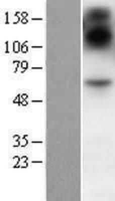 Western Blot: SIM2 Overexpression Lysate [NBP2-07499]