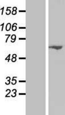 Western Blot: Sin1/MAPKAP1 Overexpression Lysate [NBP2-10750]