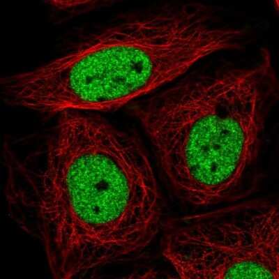 Immunocytochemistry/ Immunofluorescence: SIN3A Antibody [NBP2-38949]