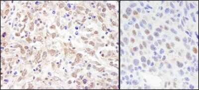 Immunohistochemistry: SIN3A Antibody [NB100-2252]