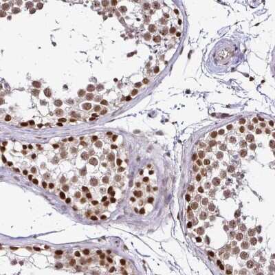 Immunohistochemistry: SIN3A Antibody [NBP2-38564]
