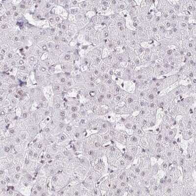 Immunohistochemistry-Paraffin: SIN3A Antibody [NBP2-38564]