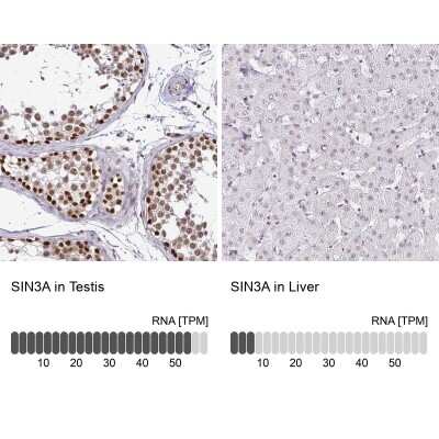 Immunohistochemistry-Paraffin: SIN3A Antibody [NBP2-38564]