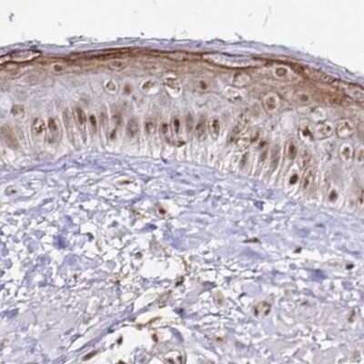 Immunohistochemistry-Paraffin: SIN3A Antibody [NBP2-38564]