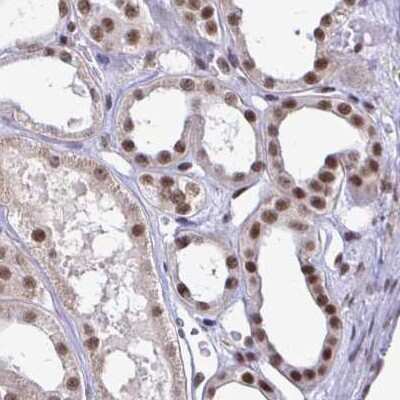 Immunohistochemistry-Paraffin: SIN3A Antibody [NBP2-38564]