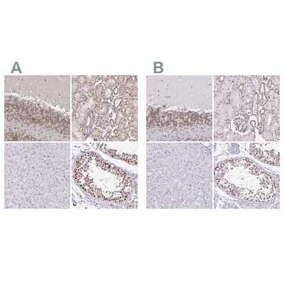 Immunohistochemistry-Paraffin: SIN3A Antibody [NBP2-38564]