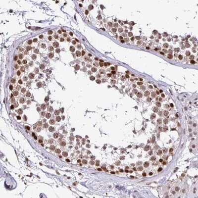 Immunohistochemistry-Paraffin: SIN3A Antibody [NBP2-38564]