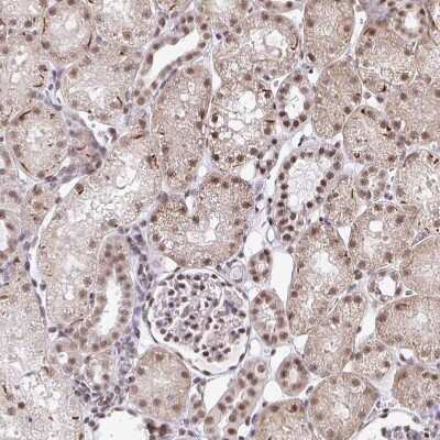 Immunohistochemistry-Paraffin: SIN3A Antibody [NBP2-38564]