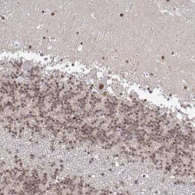 Immunohistochemistry-Paraffin: SIN3A Antibody [NBP2-38564]