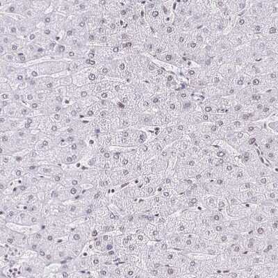 Immunohistochemistry-Paraffin: SIN3A Antibody [NBP2-38564]