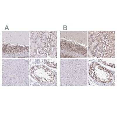 Immunohistochemistry-Paraffin: SIN3A Antibody [NBP2-38949]