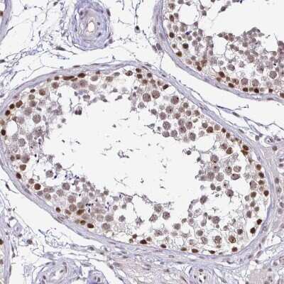 Immunohistochemistry-Paraffin: SIN3A Antibody [NBP2-38949]