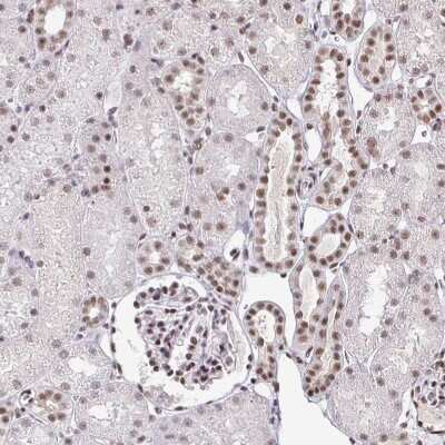 Immunohistochemistry-Paraffin: SIN3A Antibody [NBP2-38949]