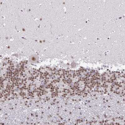 Immunohistochemistry-Paraffin: SIN3A Antibody [NBP2-38949]