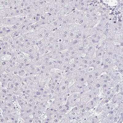 Immunohistochemistry-Paraffin: SIN3A Antibody [NBP2-38949]
