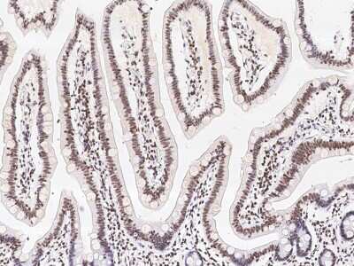 Immunohistochemistry-Paraffin: SIN3A Antibody [NBP2-98901]