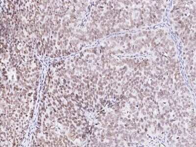 Immunohistochemistry-Paraffin: SIN3A Antibody [NBP2-98901]