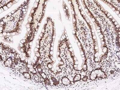 Immunohistochemistry-Paraffin: SIN3A Antibody [NBP2-98964]