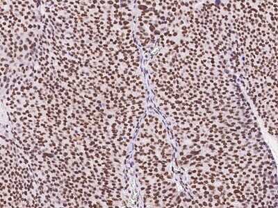 Immunohistochemistry-Paraffin: SIN3A Antibody [NBP2-98964]