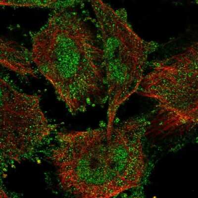 Immunocytochemistry/ Immunofluorescence: SIN3B Antibody [NBP2-13309]