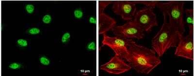 Immunocytochemistry/ Immunofluorescence: SIN3B Antibody [NBP2-20367]