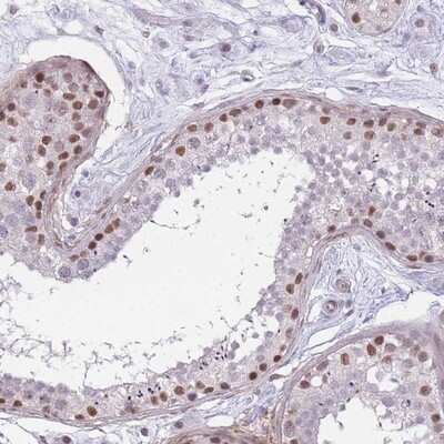 Immunohistochemistry-Paraffin: SIN3B Antibody [NBP2-13309]