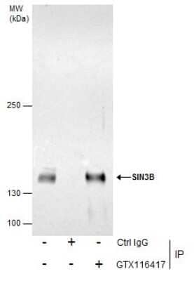 Immunoprecipitation: SIN3B Antibody [NBP2-20368]